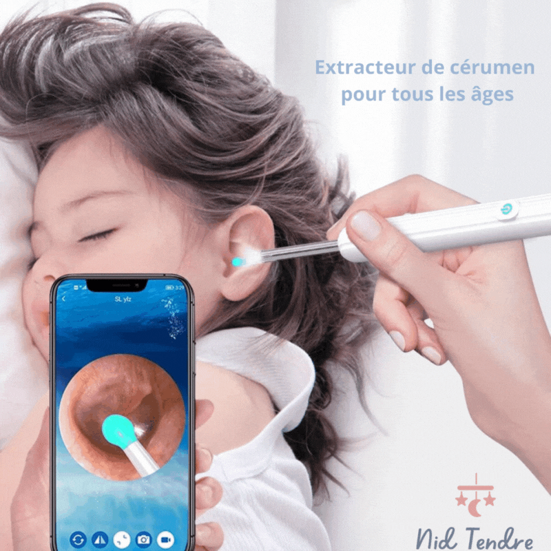 Nettoyant Oreille Otoscope,  Camera Oreille D'élimination Du Cérumen  |  EarexPro™